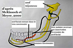 lfd64 juin 2011 analysesolanesth 50 53