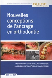 Nouvelles Conceptions de lancrage en orthodontie