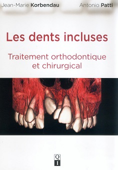 Quintessence dents incluses