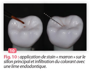 application-de-stain-marron