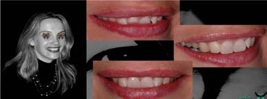 Fig. 7 : Changements majeurs de l’expression du sourire de la patiente