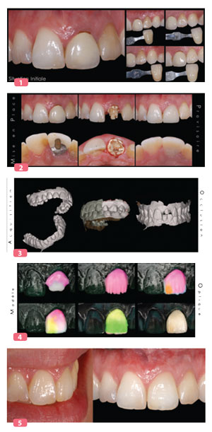 cfao-semi-directe-cas-1