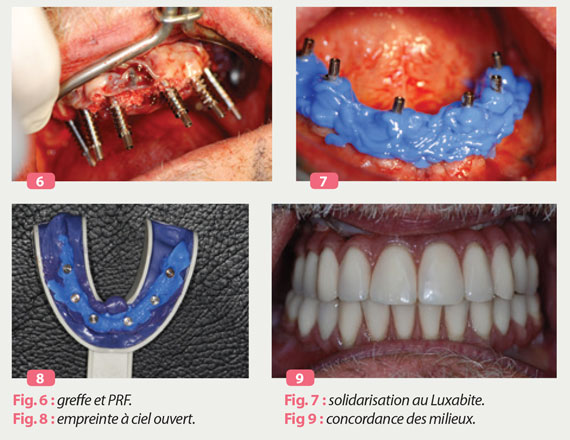 chirurgie-cad-cam