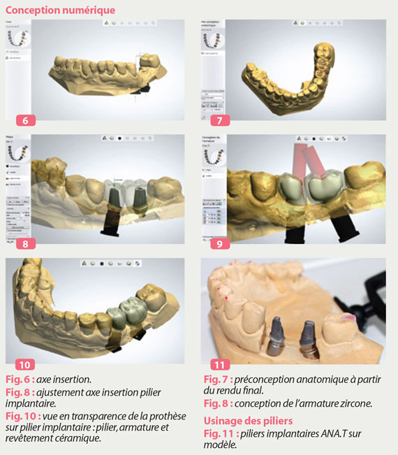 conception-numerique-du-modele