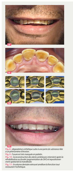 esthetique-par-reconstruction-globale