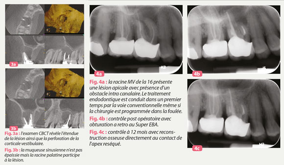 examen-cbct