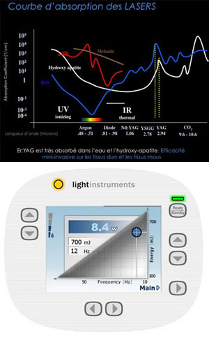 light-instruments-erbium-yag