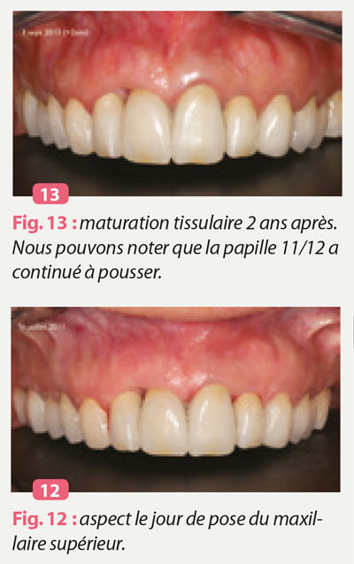 maturation-tissulaire