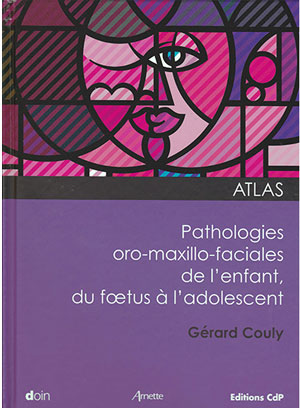 pathologies-oro-maxillo-faciales-de-lenfant