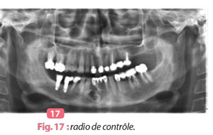 radio-de-controle