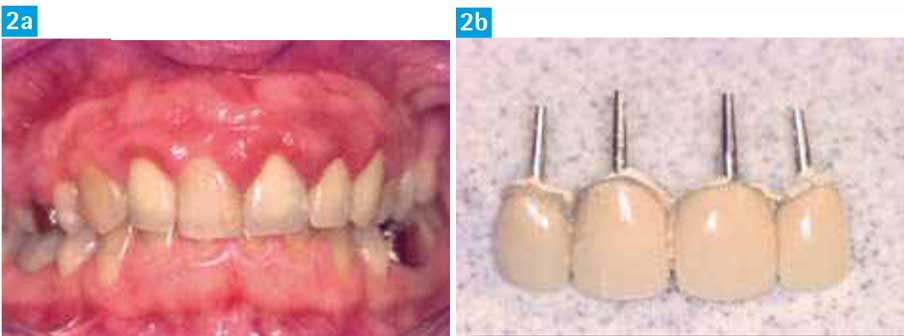 Environnement-dento-gingival