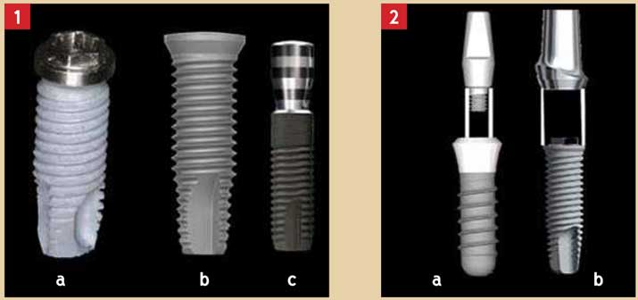 Implant-à-connexion-externe