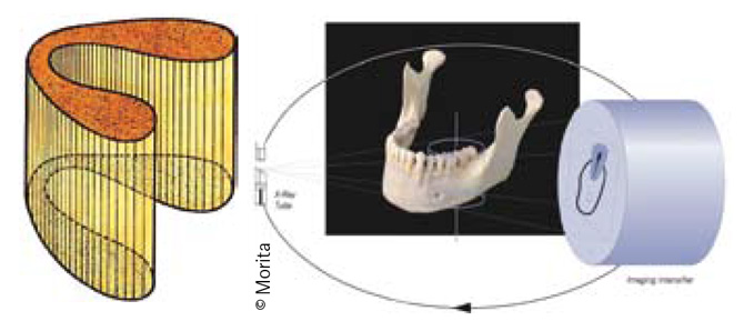 Avec-notre-CBCT