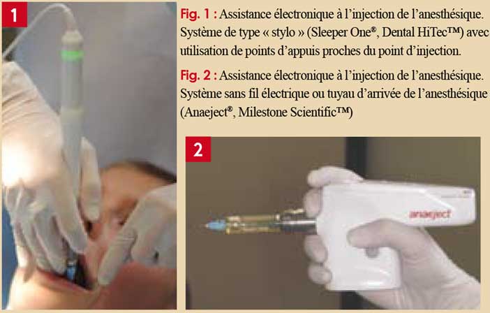 Assistance-électronique-à-l’injection-de-l’anesthésique