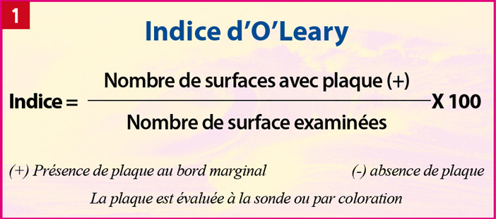 Indice-d’O’Leary