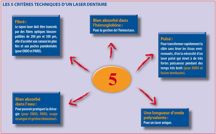 LES-5-CRITERES-TECHNIQUES-D-UN-LASER-DENTAIRE