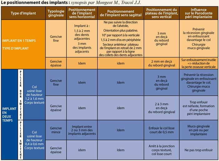 Le-positionnement-des-implants