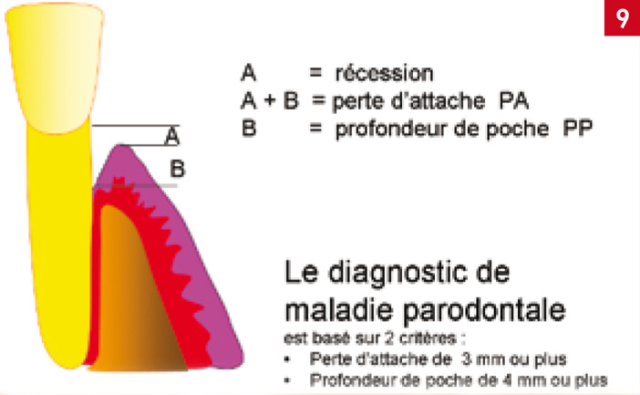 Le-sondage