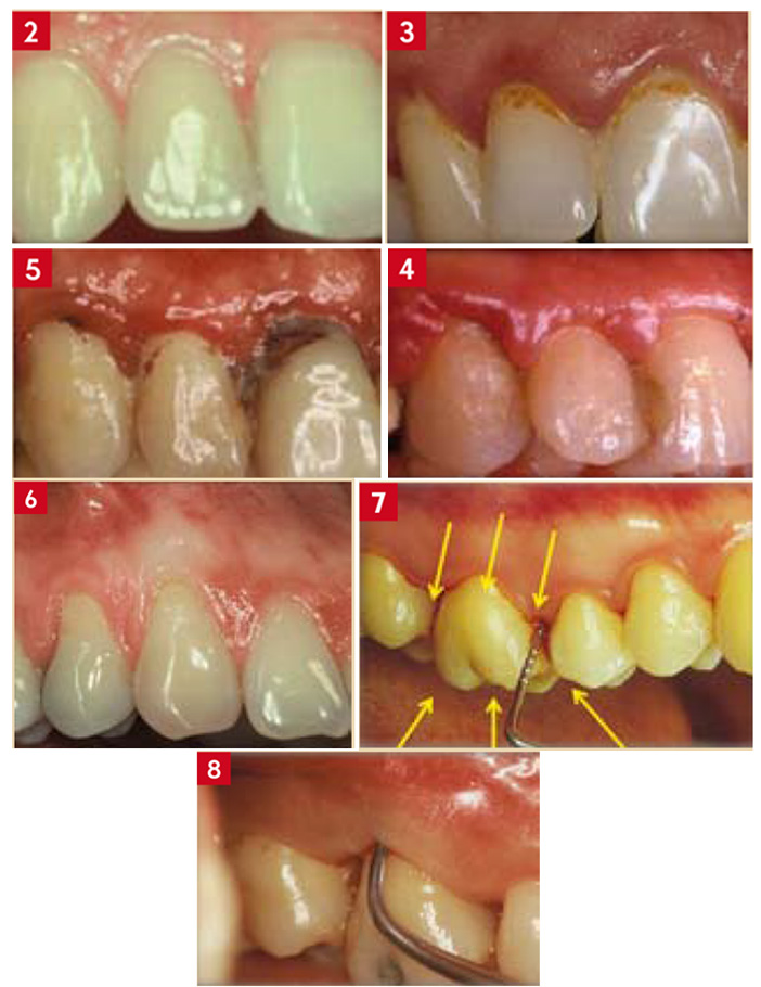 L’examen-péri-buccal-et-buccal