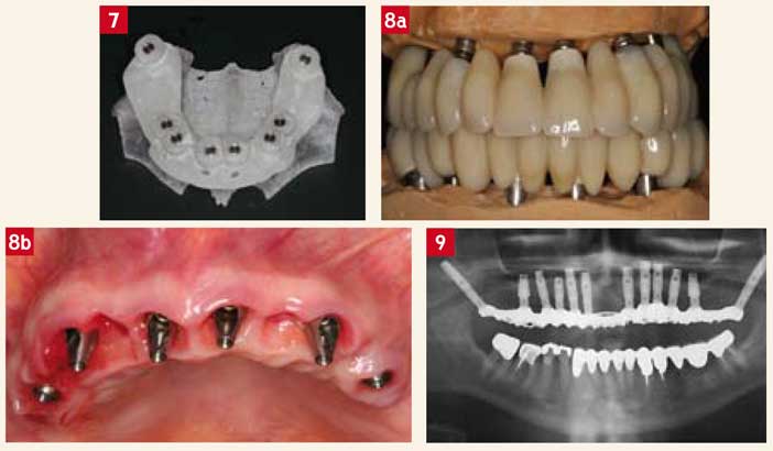 Patient-de-forte-corpulence