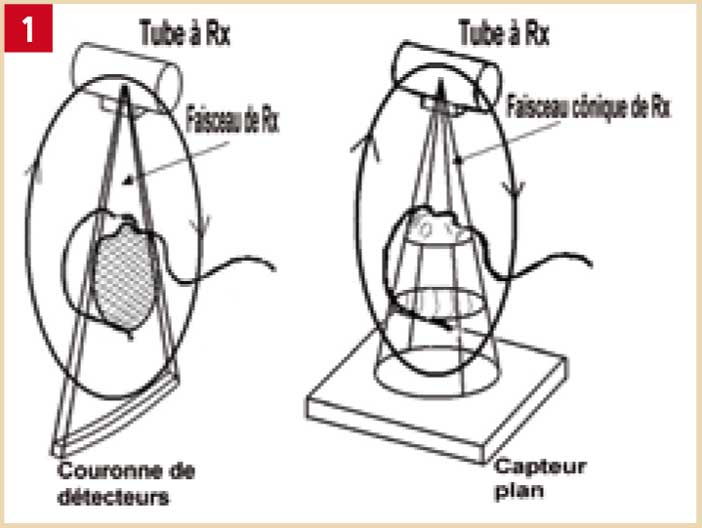 Principe-du-Cone-Beam