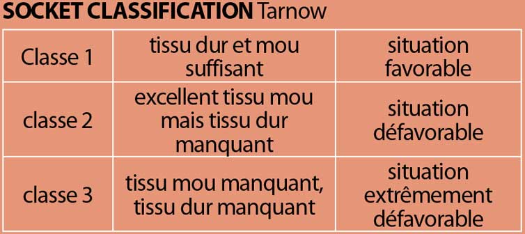 SOCKET-CLASSIFICATION-Tarnow