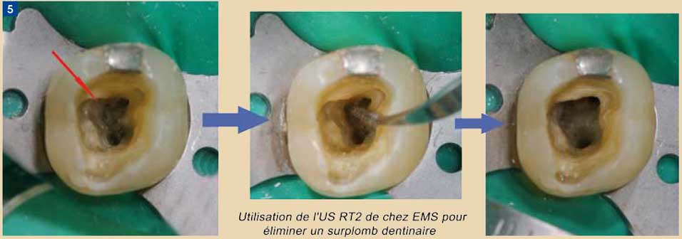 Utilisation-de-la-rotation-continue