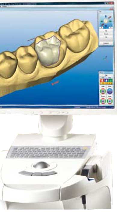 acquérir-un-CEREC