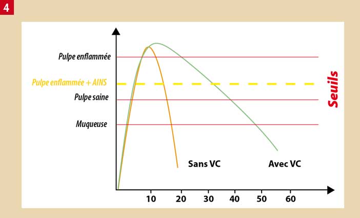 anesthésie-de-la-pulpe