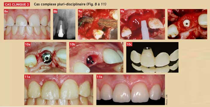 complexe-cas-pluri-disciplinaire