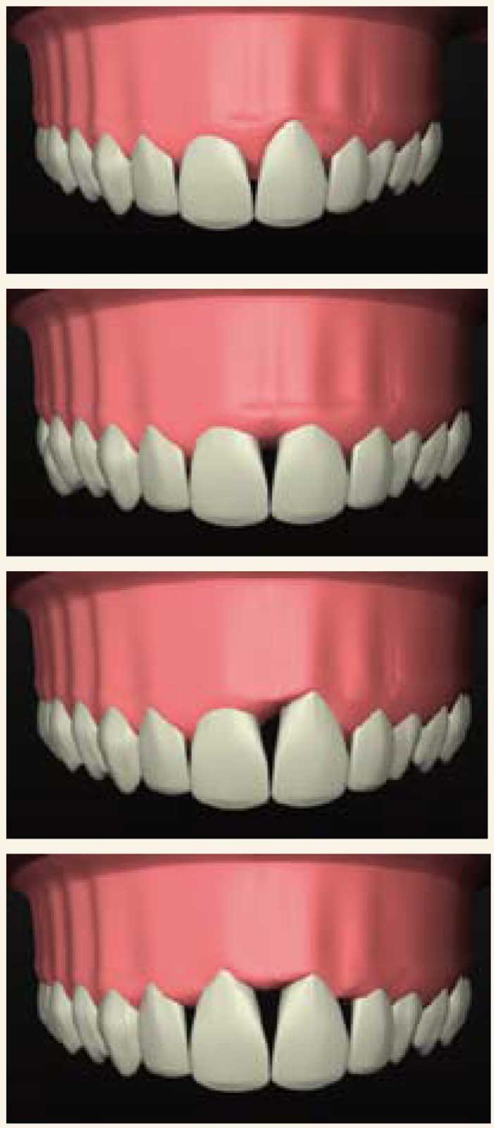 l’anatomie-des-dents