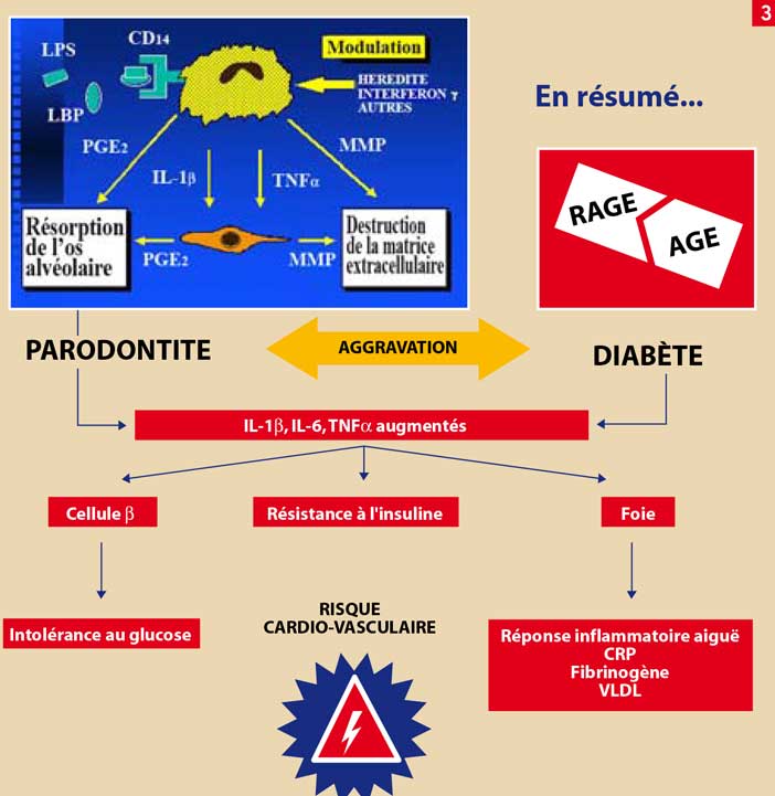 maladie-inflammatoire-chronique