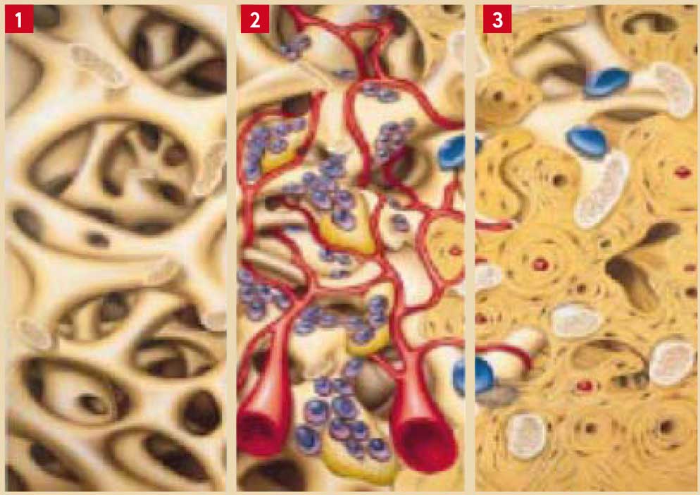 vascularisation-du-site