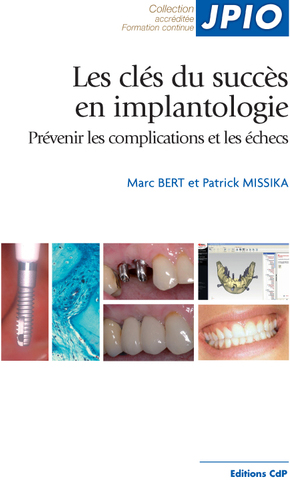 Les clés du succès en implantologie