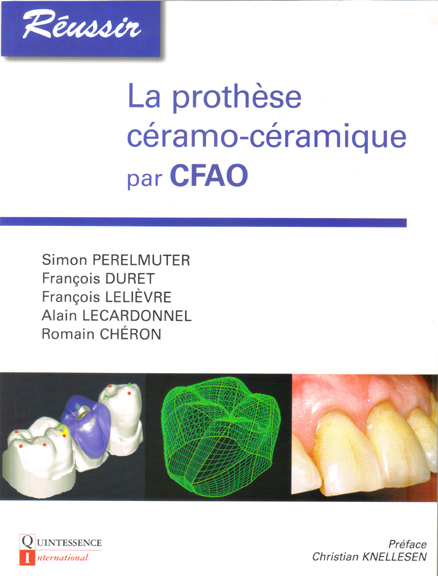 prothèse-ceramo-ceramique