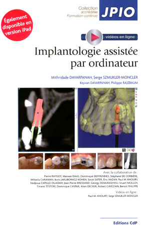 Implantologie assistée