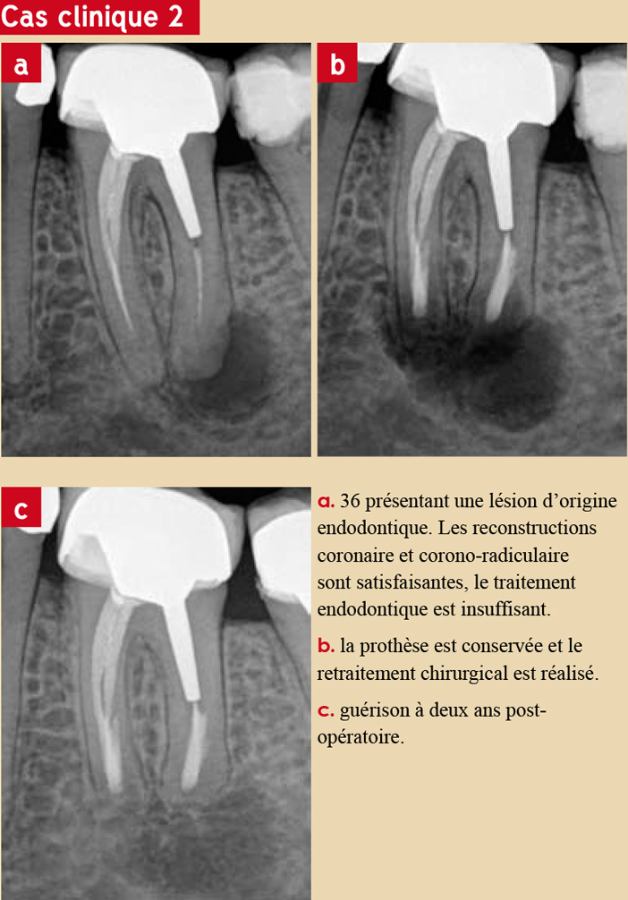 Évaluation-de-la-restauration