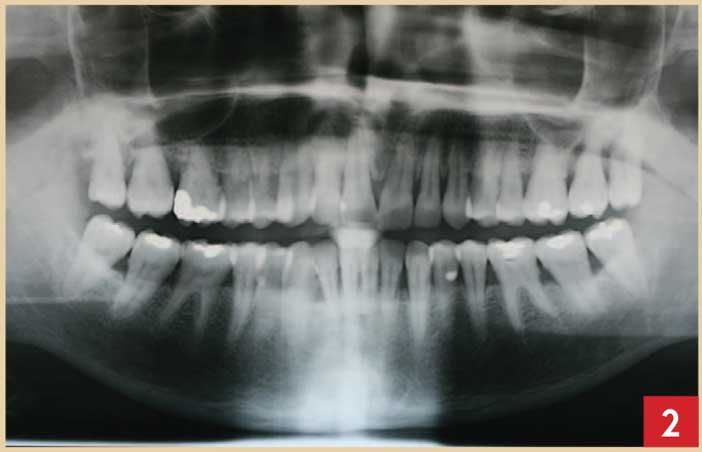 Examen-radiographique