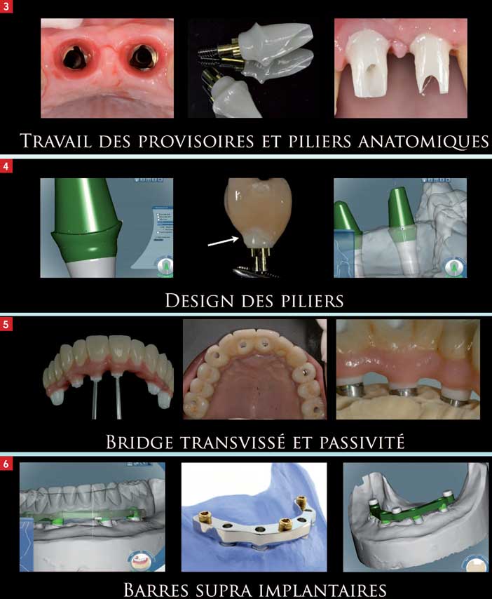 Les-infrastructures