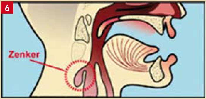 L Halitose Fleau De Sante Publique La Diagnostiquer Et La Traiter Lefildentaire Magazine Dentaire