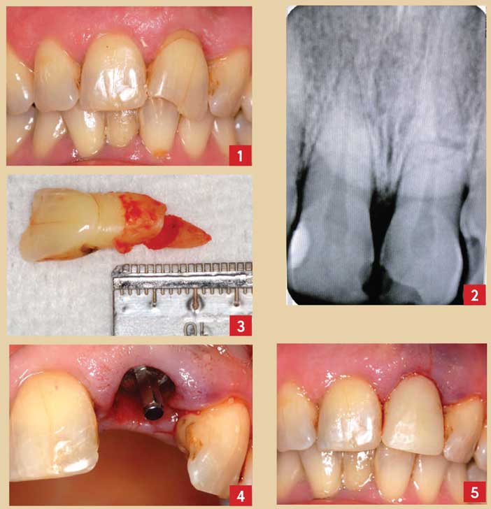 examen-clinique-endobuccal