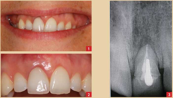 examen-clinique-exobuccal