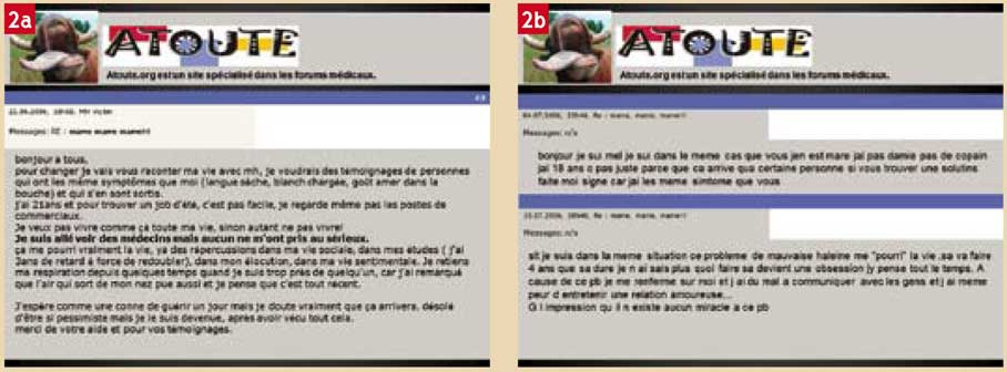 L Halitose Fleau De Sante Publique La Diagnostiquer Et La Traiter Lefildentaire Magazine Dentaire