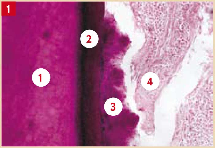 spicule-de-tartre