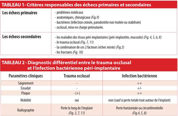 Critères-responsables-des-échecs