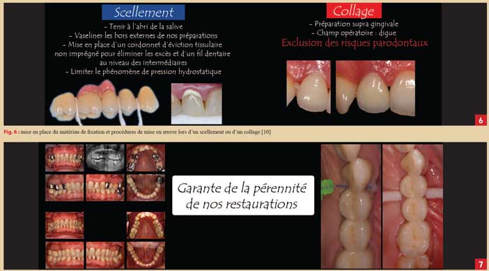 Mise-en-place-du-matériau-de-fixation