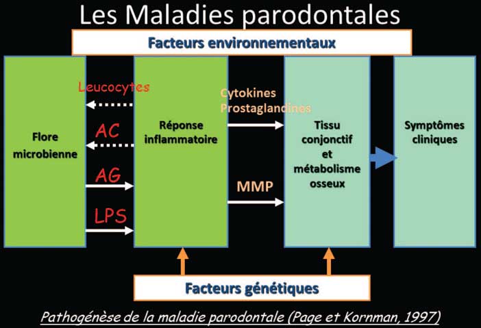 les-maladies-parodontaux