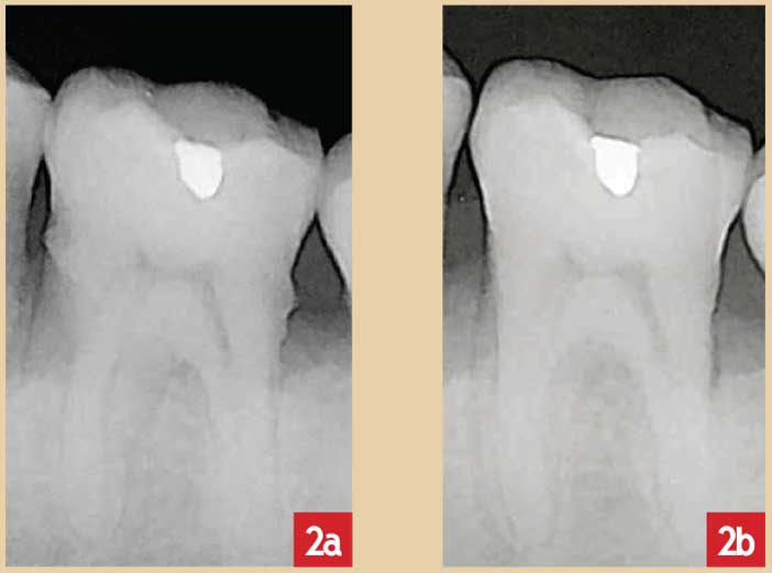 visualisation-radiographique