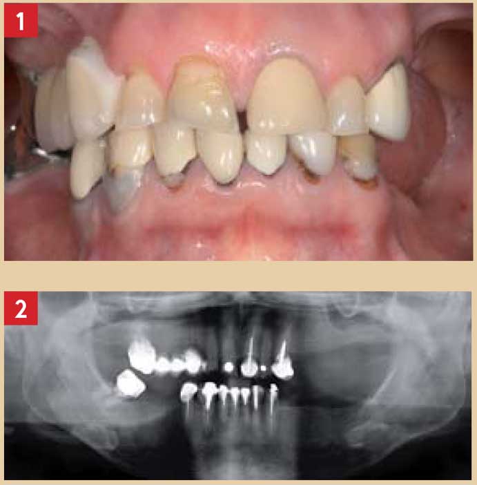 Diagnostic-parodontal