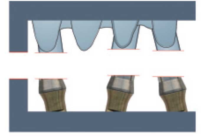 extensions-de-l’armature